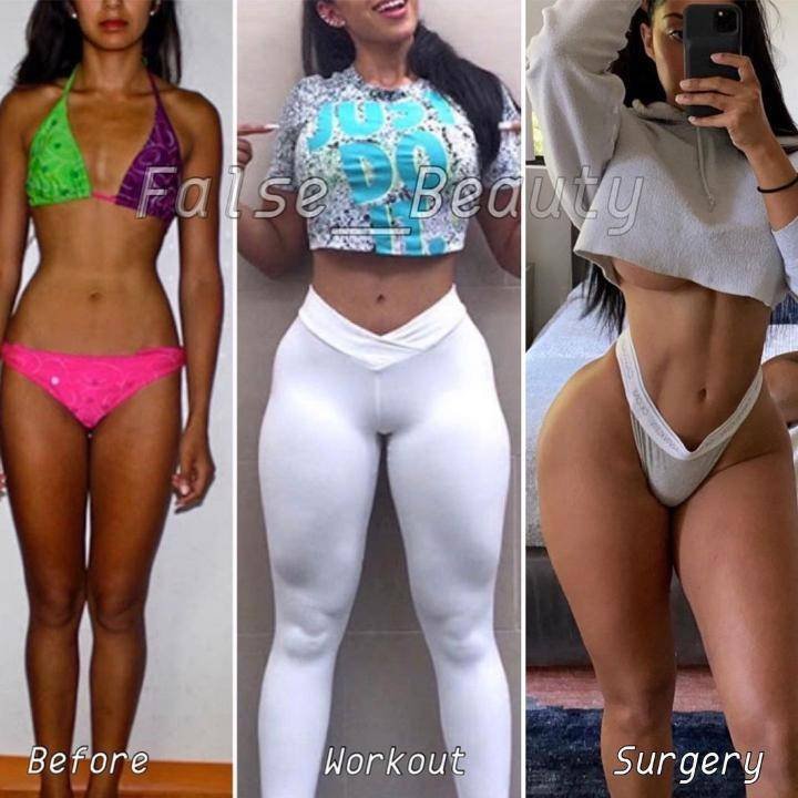 Before and After Pictures of Instagram Influencers