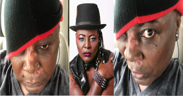 Charly Boy Involved In Awful Scooter Accident