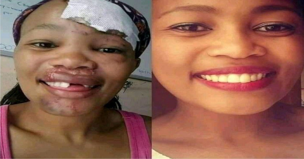 PHOTOS: Guy Removes Girlfriend’s Teeth With Plier After She Broke His TV