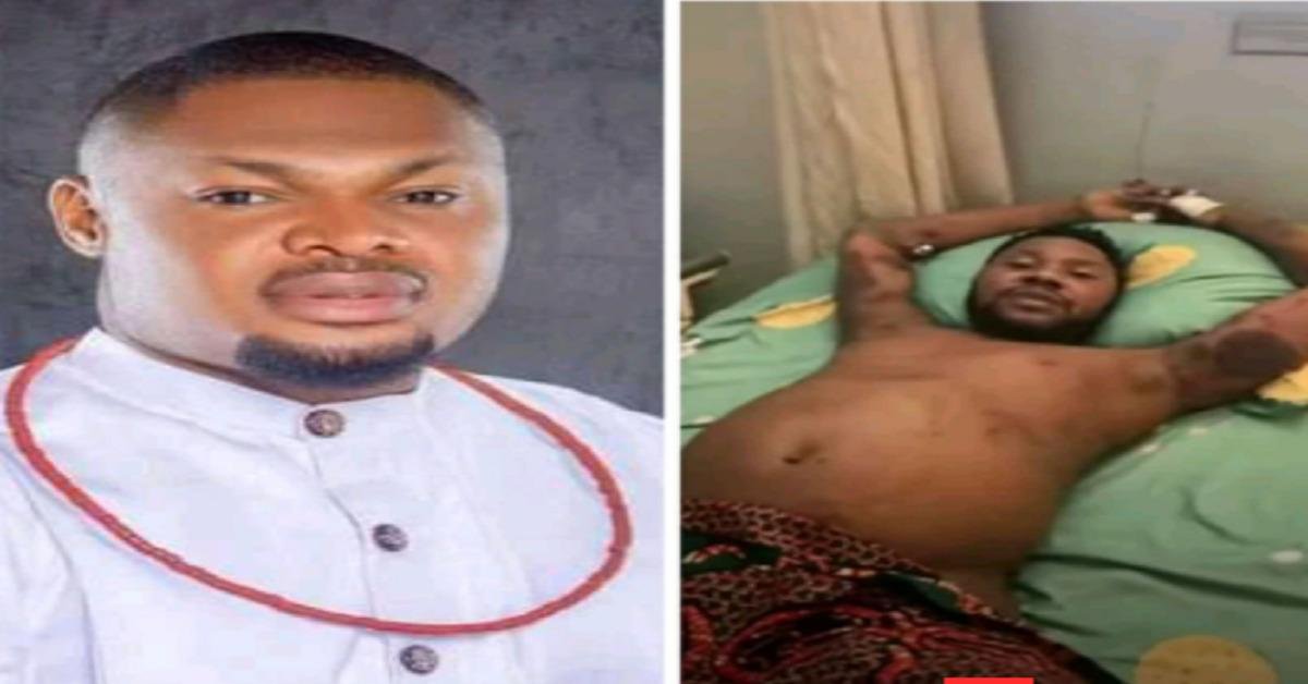 "I Am Ready To Donate One Of My Kidney If It Matches Chinedu Nwadike's Own" - Harrison Gwamnishu Pledges