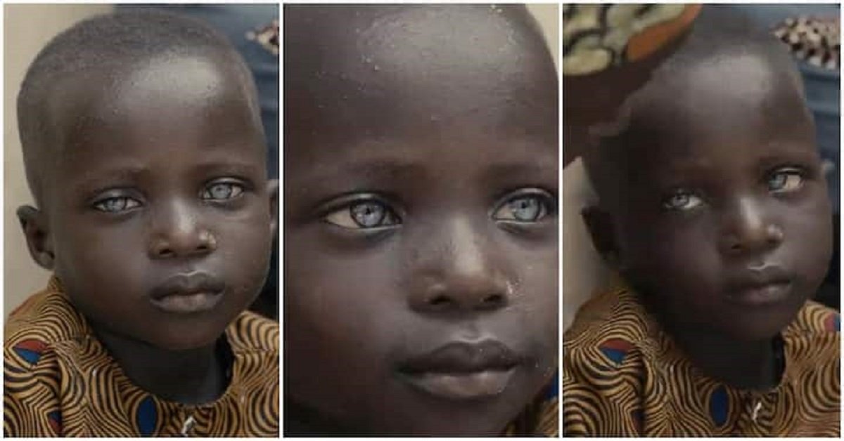 Video of A Little Boy Goes Viral Due to His Black Shiny Skin and Strange Eyeballs