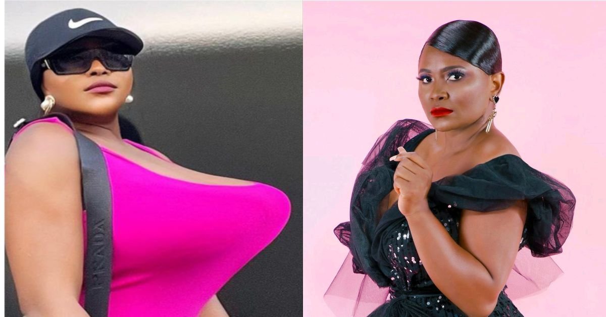 I'm Challenging Everybody Saying My Surgery Is Photoshop To $20,000, I'll Show It Eyes For Eye"- Sonia Ogiri